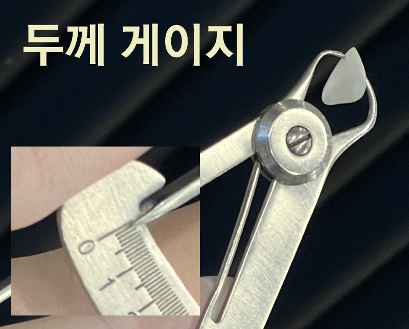 무삭제 라미네이트 90%가 후회한다는데 진짜 이유는? 본문 이미지 03