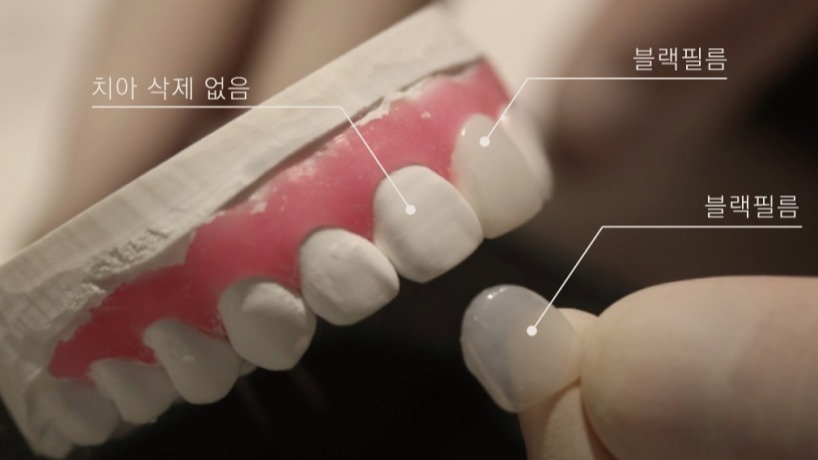 보증 10년이 기본인 블랙필름,
왜 10년을 약속할 수 있는가 본문 이미지 03